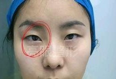 小孩爆料妈妈双眼皮视频,小孩视频意外曝光惊人真相